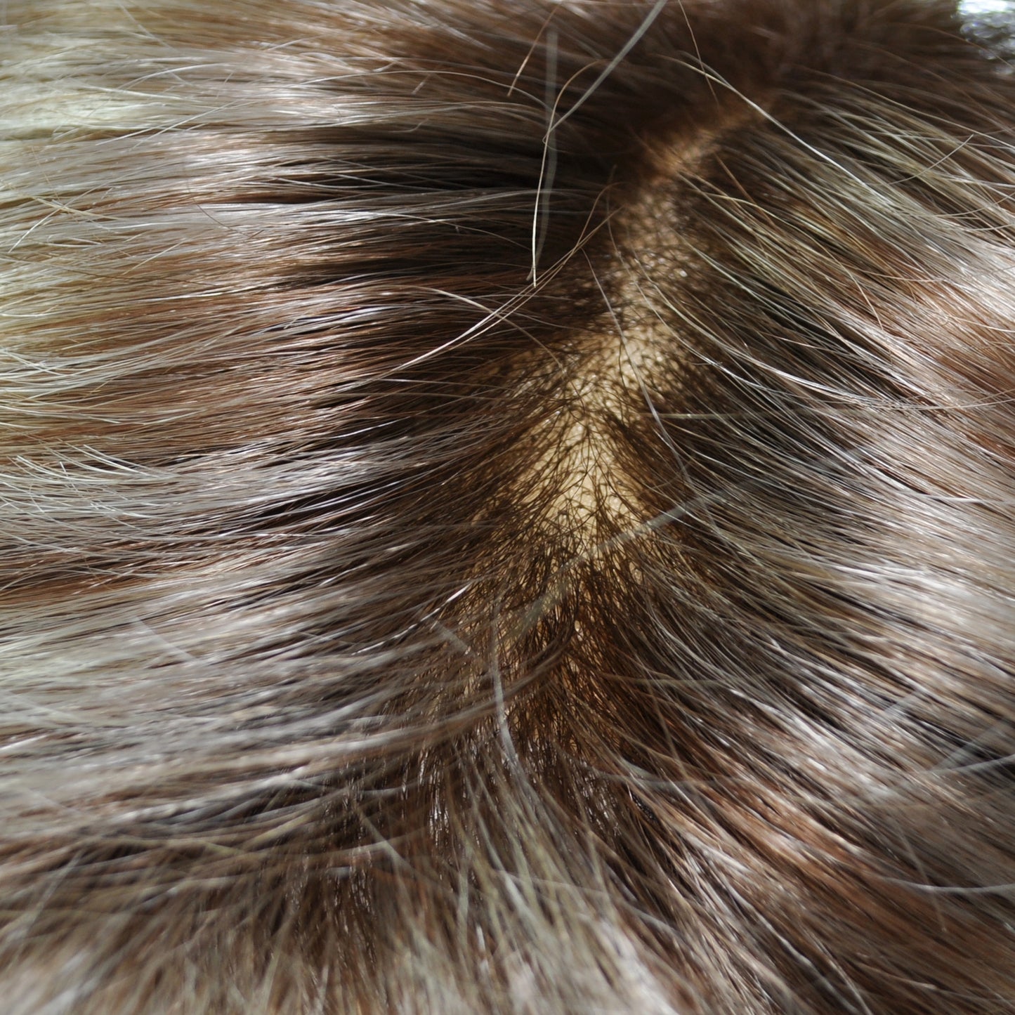 RX ANIPW Prosthetic Wig