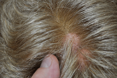RX SPKS 100% Hand tied,Lite Weight,Fine Monofilamant & Lace Prosthetic Wig