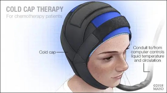 Chemotherapy, Radiation, Hair Loss & You - Cold Caps